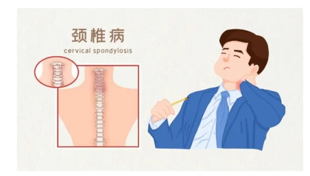 Tentang Insomnia? Sudahkah Anda mempertimbangkan penyebab tulang belakang leher?