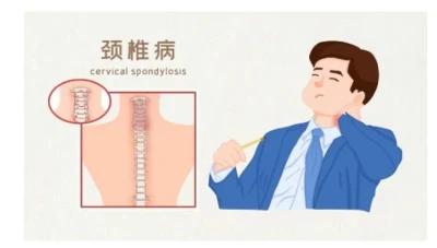 Tentang Insomnia? Sudahkah Anda mempertimbangkan penyebab tulang belakang leher?